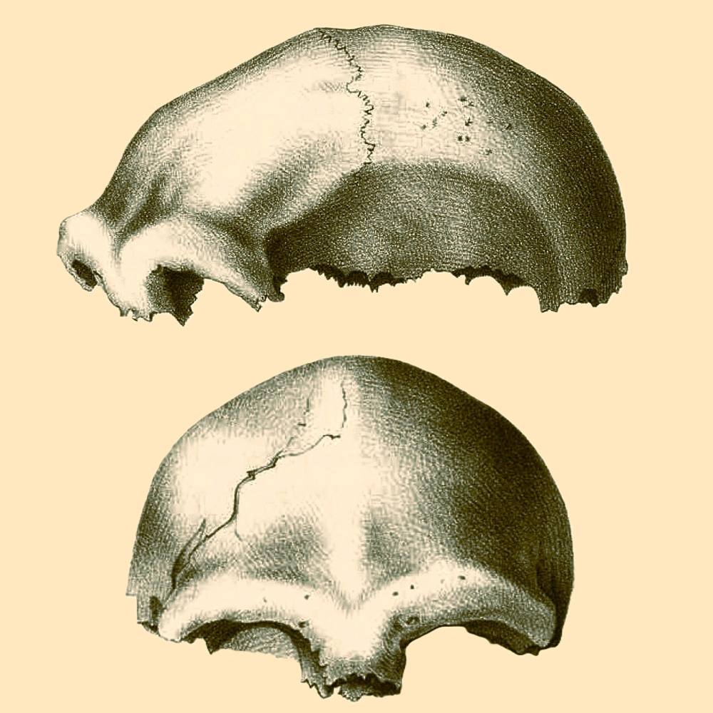 Calota craniana do espécime Neanderthal 1, descoberto na Feldhofer Grotte, Vale de Neander, Alemanha, em 1856.